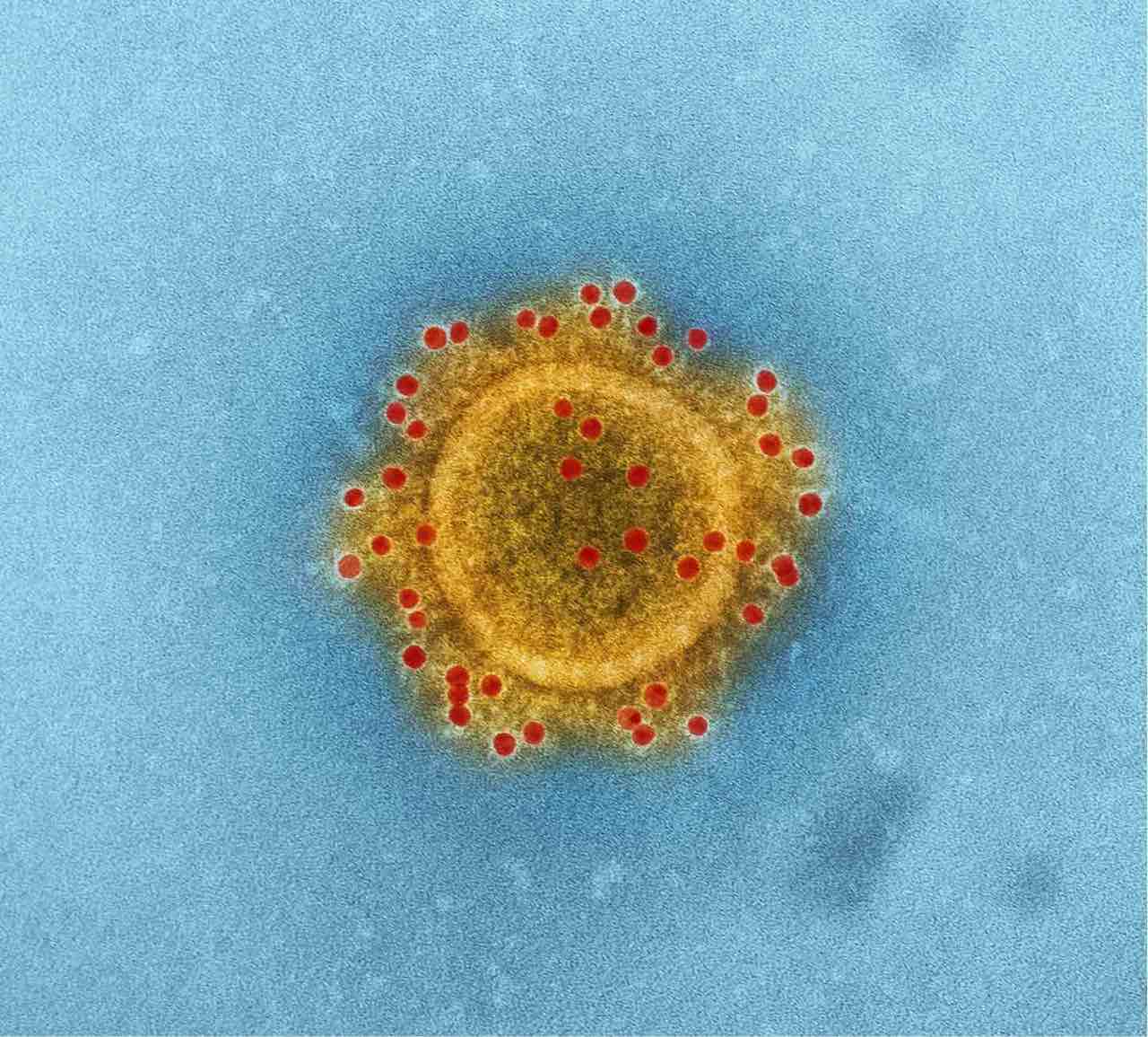 Elektronenmikroskopische Aufnahme eines Corona-Virus